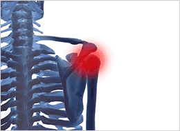 関節に本来の動きを取り戻す